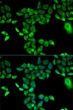 FMO3 Polyclonal Antibody