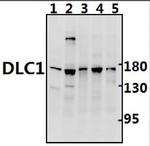 DLC1 Polyclonal Antibody