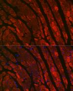 Cardiac Troponin C Polyclonal Antibody