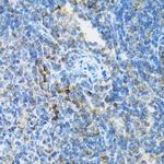 UBE2D1 Polyclonal Antibody