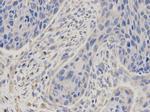 MSMB Polyclonal Antibody