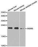 MSMB Antibody in Western Blot (WB)