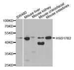 HSD17B2 Polyclonal Antibody