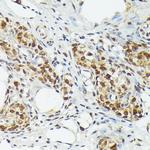 MT2A Antibody in Immunohistochemistry (Paraffin) (IHC (P))