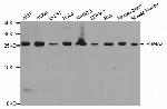PSMA2 Polyclonal Antibody
