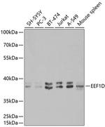 EEF1D Polyclonal Antibody