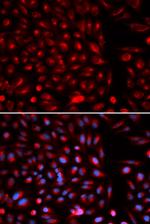 AXIN2 Polyclonal Antibody