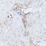 GNA11 Polyclonal Antibody