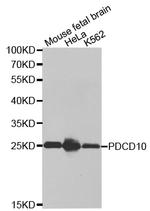 PDCD10 Polyclonal Antibody