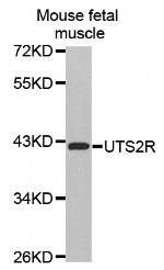 Urotensin II Receptor Polyclonal Antibody