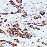 MMP25 Polyclonal Antibody
