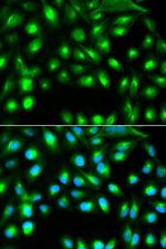 Gemin 2 Polyclonal Antibody