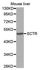 SCTR Antibody in Western Blot (WB)