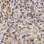 ABCA6 Polyclonal Antibody