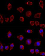 DAO Polyclonal Antibody