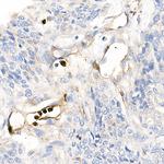 S100A12 Polyclonal Antibody