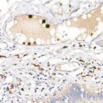 S100A12 Antibody in Immunohistochemistry (Paraffin) (IHC (P))