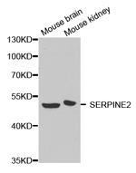 SERPINE2 Polyclonal Antibody