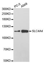 SLC4A4 Polyclonal Antibody