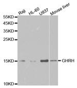 GHRH Polyclonal Antibody