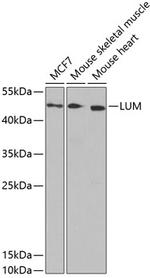 LUM Antibody in Western Blot (WB)