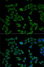 VAPB Antibody in Immunocytochemistry (ICC/IF)
