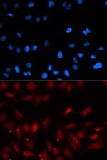 EBP1 Polyclonal Antibody