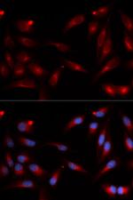 ADAM9 Polyclonal Antibody