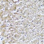 NQO2 Antibody in Immunohistochemistry (Paraffin) (IHC (P))