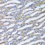 NQO2 Polyclonal Antibody