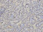 APRT Polyclonal Antibody