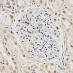 SNRPE Antibody in Immunohistochemistry (Paraffin) (IHC (P))