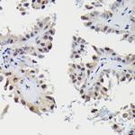SNRPE Polyclonal Antibody