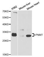 PNMT Polyclonal Antibody