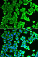 RPLP0 Polyclonal Antibody