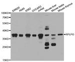 RPLP0 Antibody in Western Blot (WB)