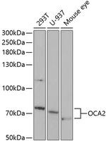 OCA2 Polyclonal Antibody