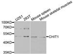 Chitotriosidase Antibody in Western Blot (WB)