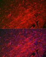 HSPB8 Antibody in Immunocytochemistry (ICC/IF)