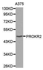 Prokineticin Receptor 2 Polyclonal Antibody