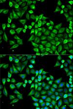 ABAT Polyclonal Antibody