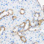 Apolipoprotein M Antibody in Immunohistochemistry (Paraffin) (IHC (P))