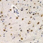 ID3 Antibody in Immunohistochemistry (Paraffin) (IHC (P))