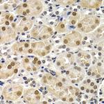 ID3 Antibody in Immunohistochemistry (Paraffin) (IHC (P))