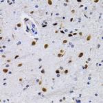 ID3 Antibody in Immunohistochemistry (Paraffin) (IHC (P))