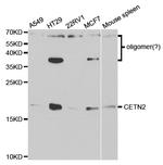 Centrin 2 Antibody in Western Blot (WB)