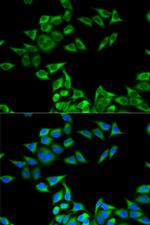 CHMP2B Polyclonal Antibody