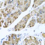 MGP Antibody in Immunohistochemistry (Paraffin) (IHC (P))
