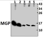 MGP Antibody in Western Blot (WB)