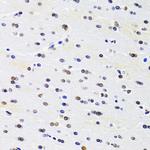 PRPF3 Antibody in Immunohistochemistry (Paraffin) (IHC (P))